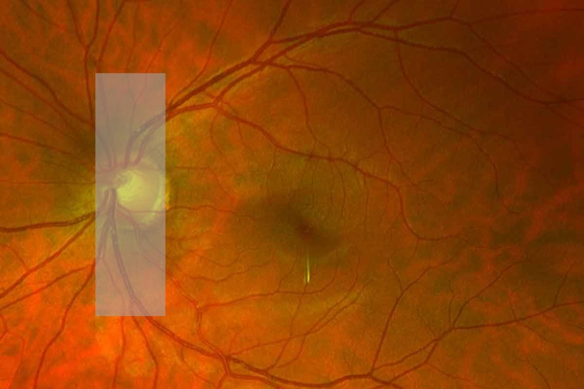 retina doctors view